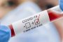 La course au vaccin anti-Covid-19 fait rage aux États-Unis et UE