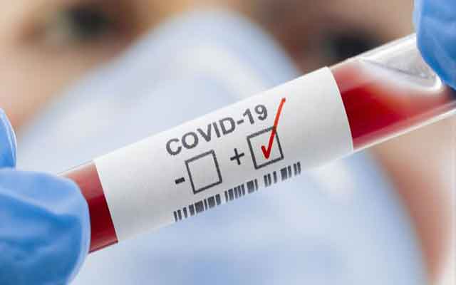 Covid-19 : le nombre de cas confirmés dépasse la barrière de 18 Millions