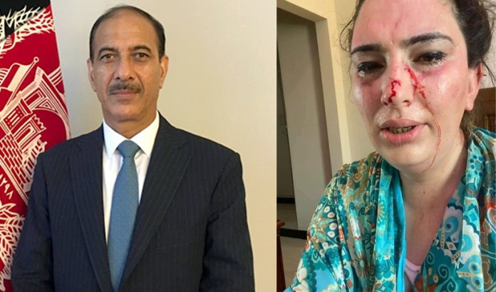 Pakistan : la fille de l'ambassadeur d'Afghanistan enlevée, torturée et libérée