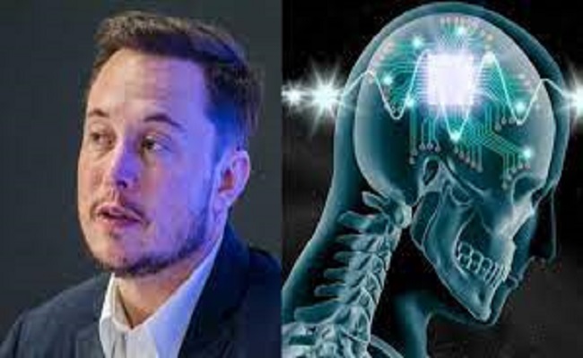 Elon Musk testera l'implantation de puces électroniques dans le cerveau humain...