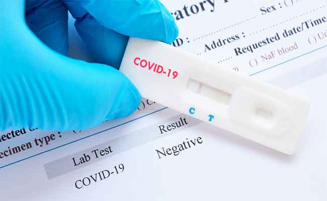 Autorisation des tests antigéniques de covid-19 dans les pharmacies d'officine