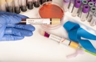 Détection de 82 nouveaux cas du variant Omicron en Algérie, selon l’IPA