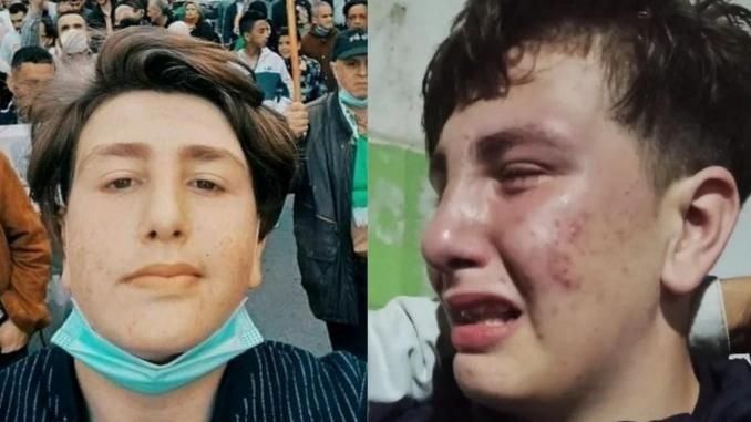 Indignation sélective : comment l&rsquo;affaire de l&rsquo;adolescent Wassim révèle les failles des droits de l&rsquo;enfant en Algérie