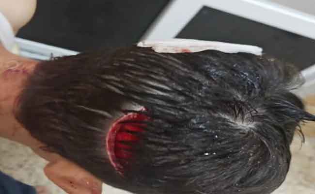Un chien non entraîné mord un enfant à Sétif
